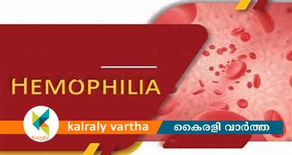 'ആശാധാര' കോട്ടയത്തും: 18ൽ താഴെയുള്ള മുഴുവൻ കുട്ടികൾക്കും ഹീമോഫീലിയ മരുന്ന് സൗജന്യം