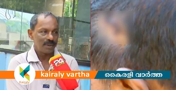 കൊല്ലത്ത് പൊറോട്ട കൊടുക്കാത്തതിന് കടയുടമയുടെ തല അടിച്ചു പൊട്ടിച്ചു