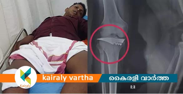 വിദ്യാർത്ഥിനിയെ ശല്യം ചെയ്തത് ചോദ്യം ചെയ്തു; കണ്ണൂരിൽ എസ്എഫ്‌ഐ നേതാവിന് കുത്തേറ്റു